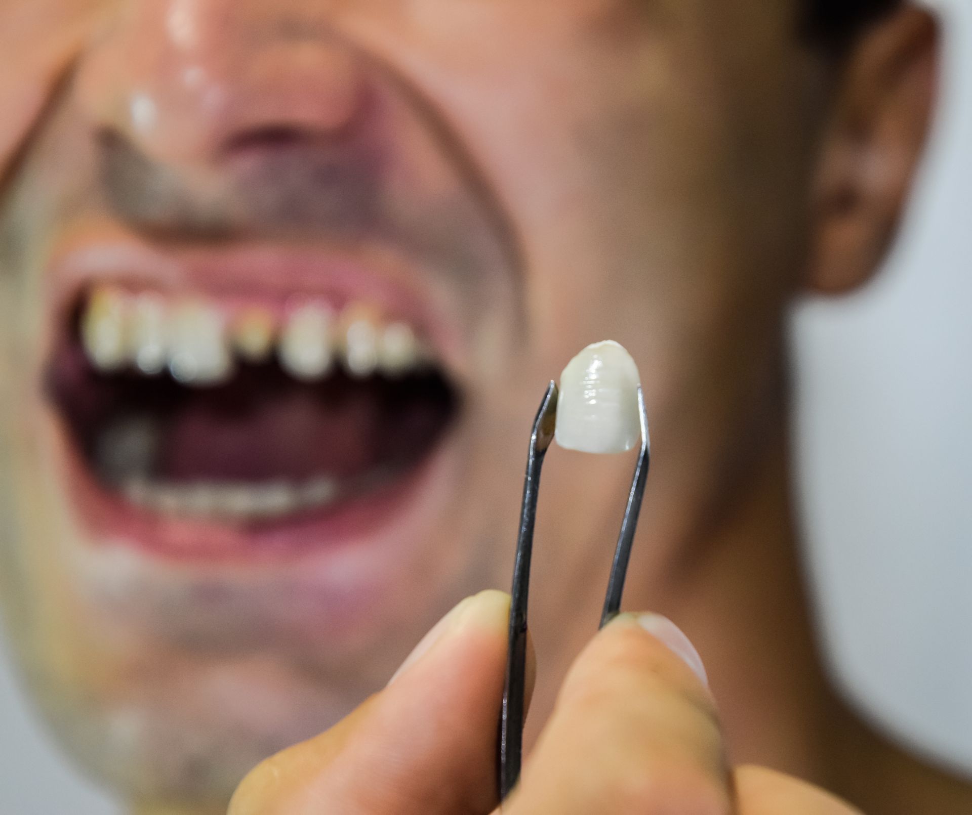 A man is holding a tooth with tweezers in front of his mouth.
