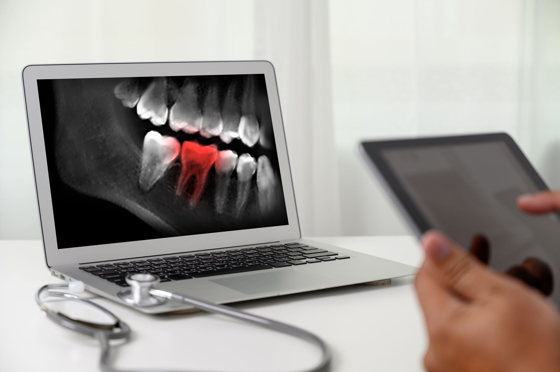 A person is looking at an x-ray of a tooth on a laptop.