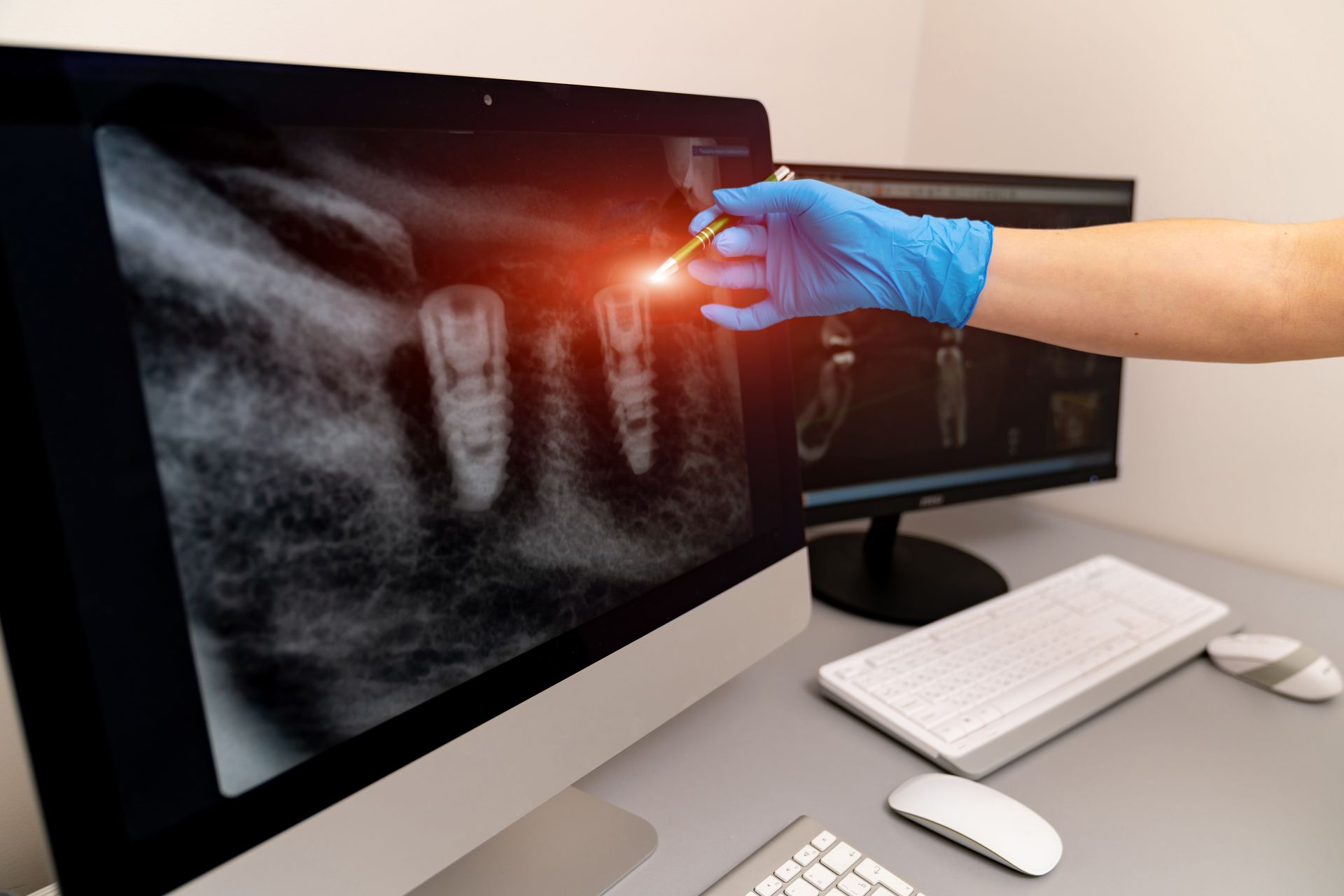 A dentist is looking at an x-ray of a tooth on a computer screen.