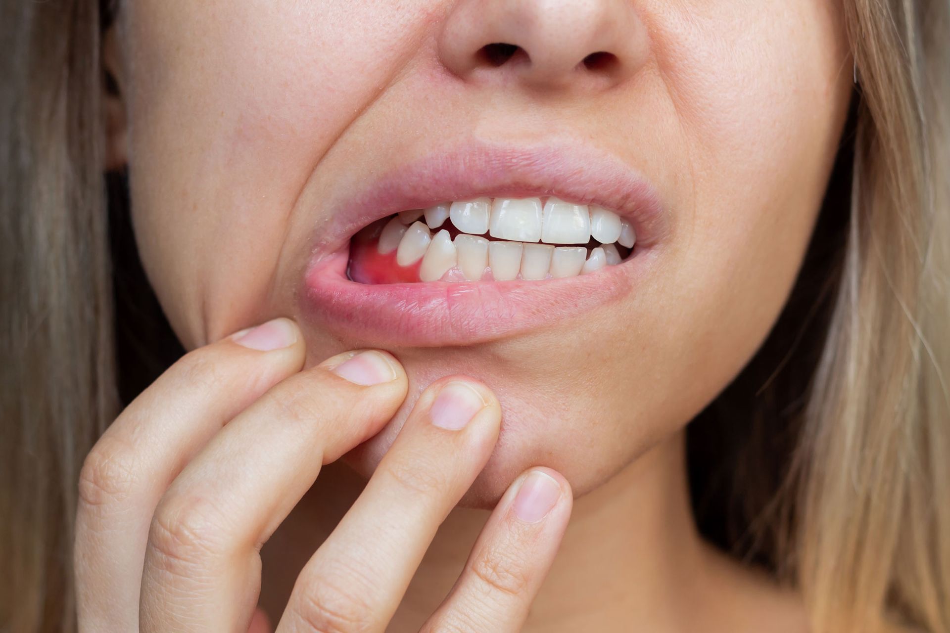 A woman is holding her mouth in pain because of a toothache.