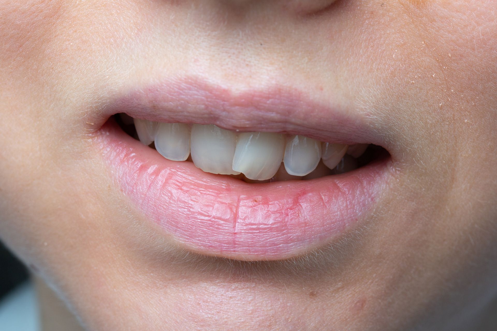 A close up of a woman 's mouth with white teeth and pink lips.