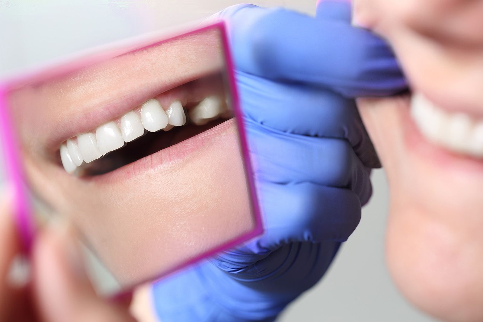 A woman is looking at her teeth in a mirror.