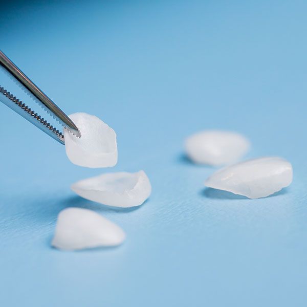 A pair of tweezers is holding a piece of dental veneer on a blue surface.