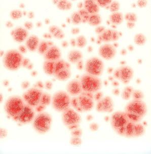 Red Crystals