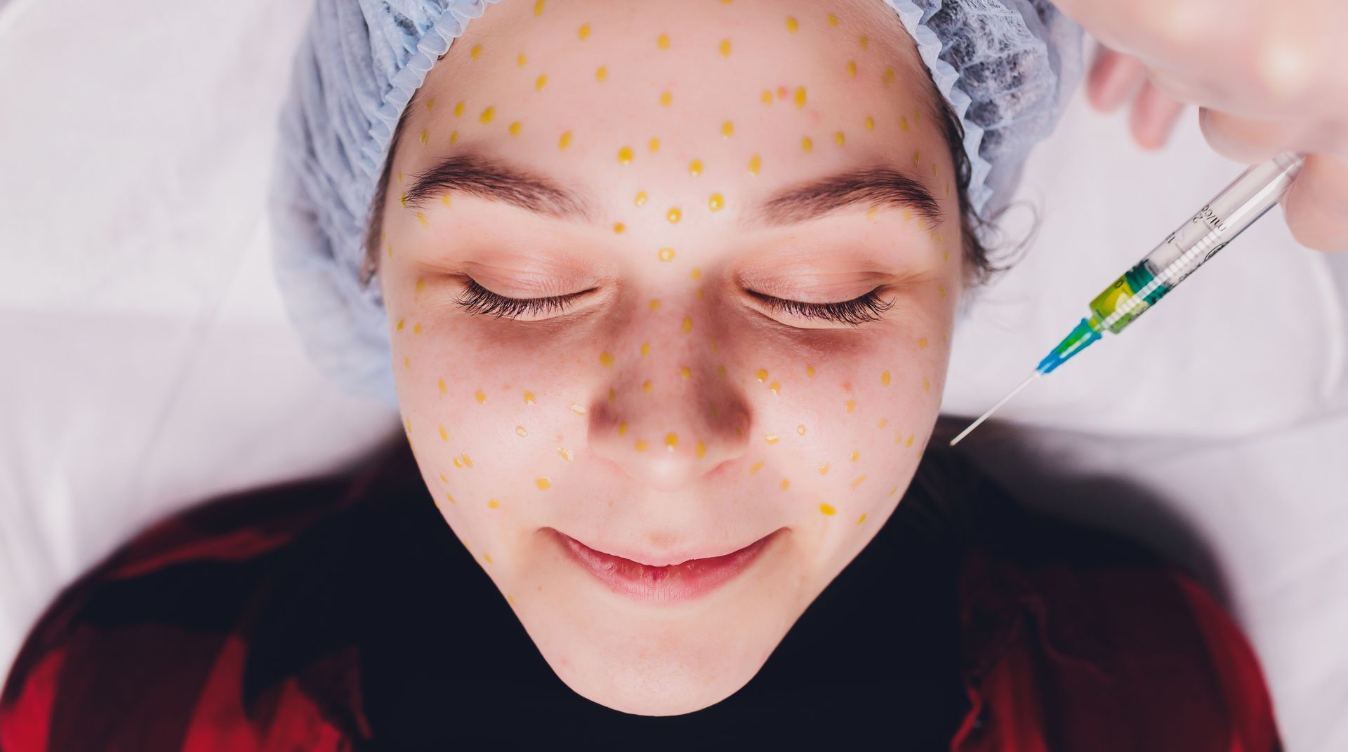 A woman is getting a botox injection in her face.