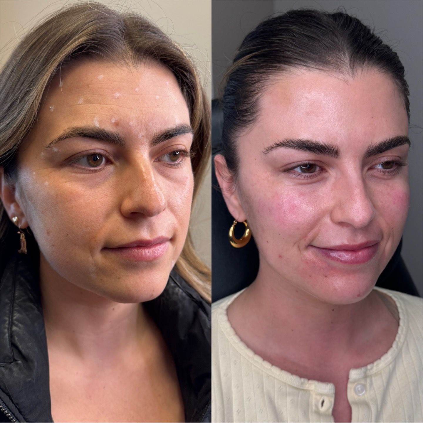 Side-by-side portrait of the same woman before and after, with a lighter complexion and subtle smile.