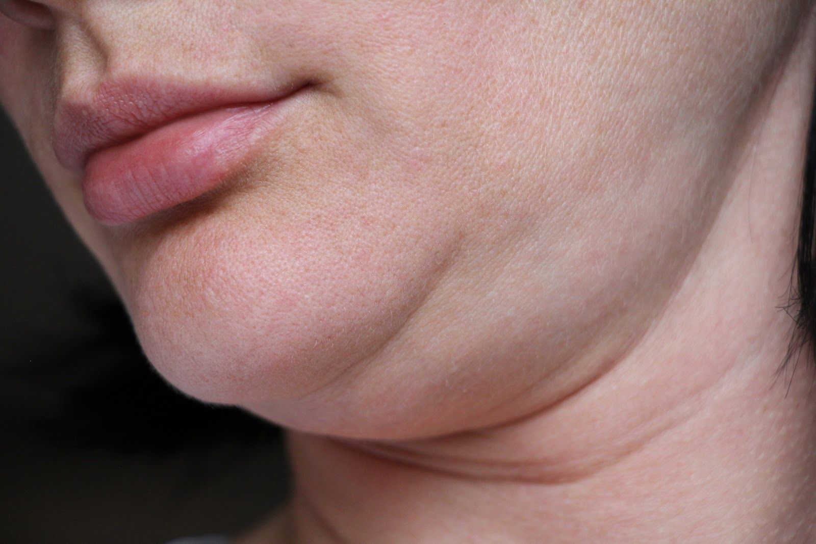 Close-up of a person’s chin and neck showing a double chin