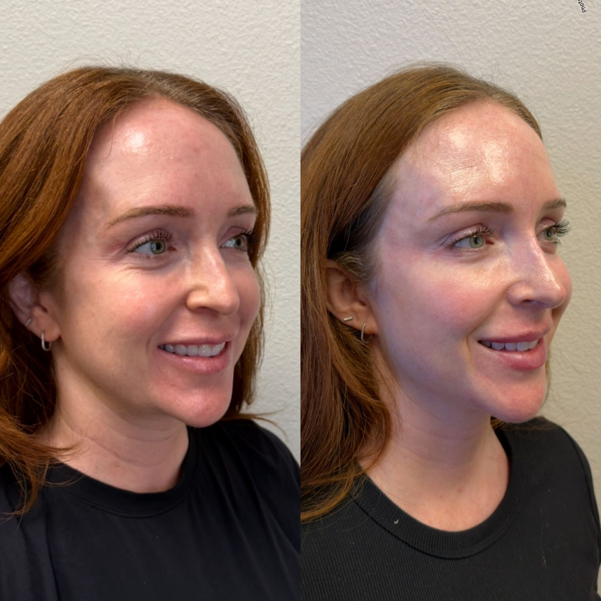 Side-by-side profile views of a woman with red hair in a black shirt, smiling against a plain wall
