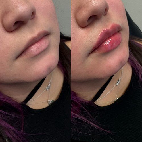 Close-up of a face with glossy pink lips, shown side by side with a matte lip look.