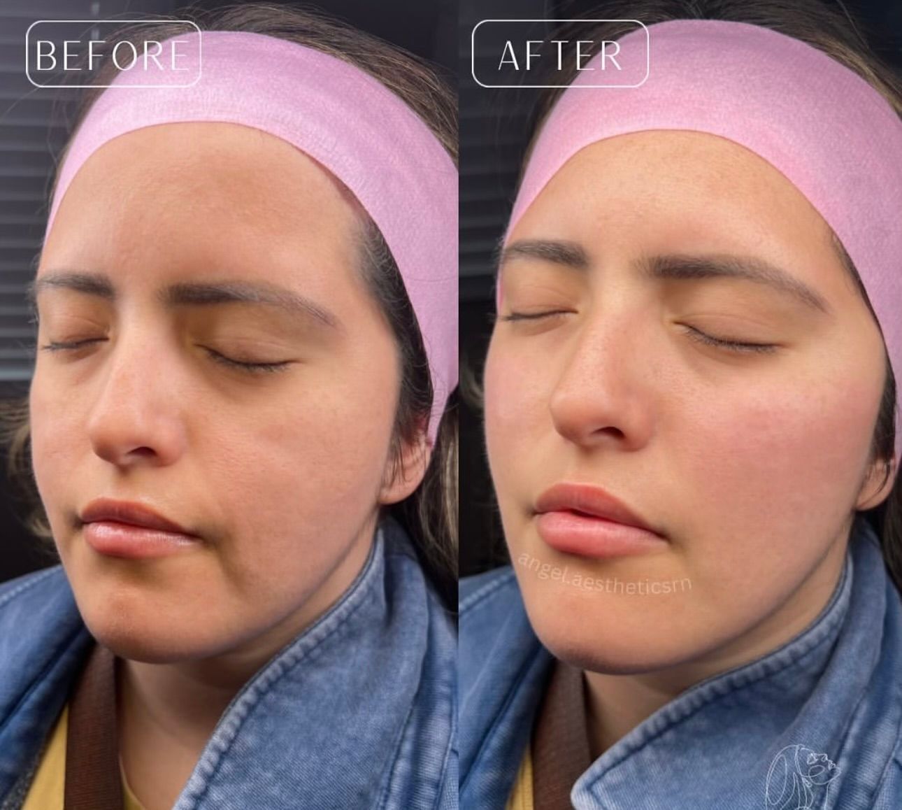 Side-by-side before and after of a woman with eyes closed, showing smoother skin and makeup differences.