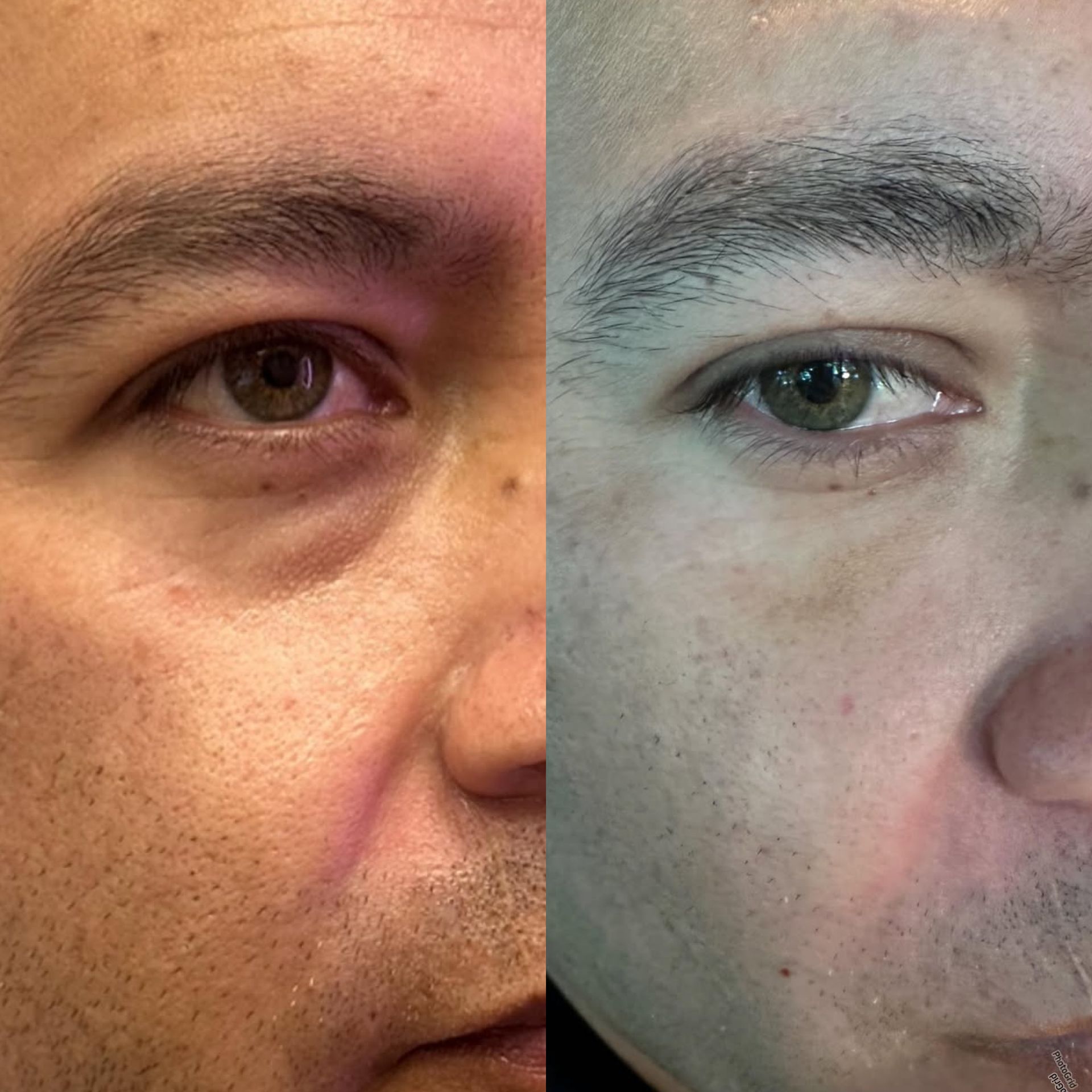Side-by-side close-up of the same face with different skin tones under varying lighting.