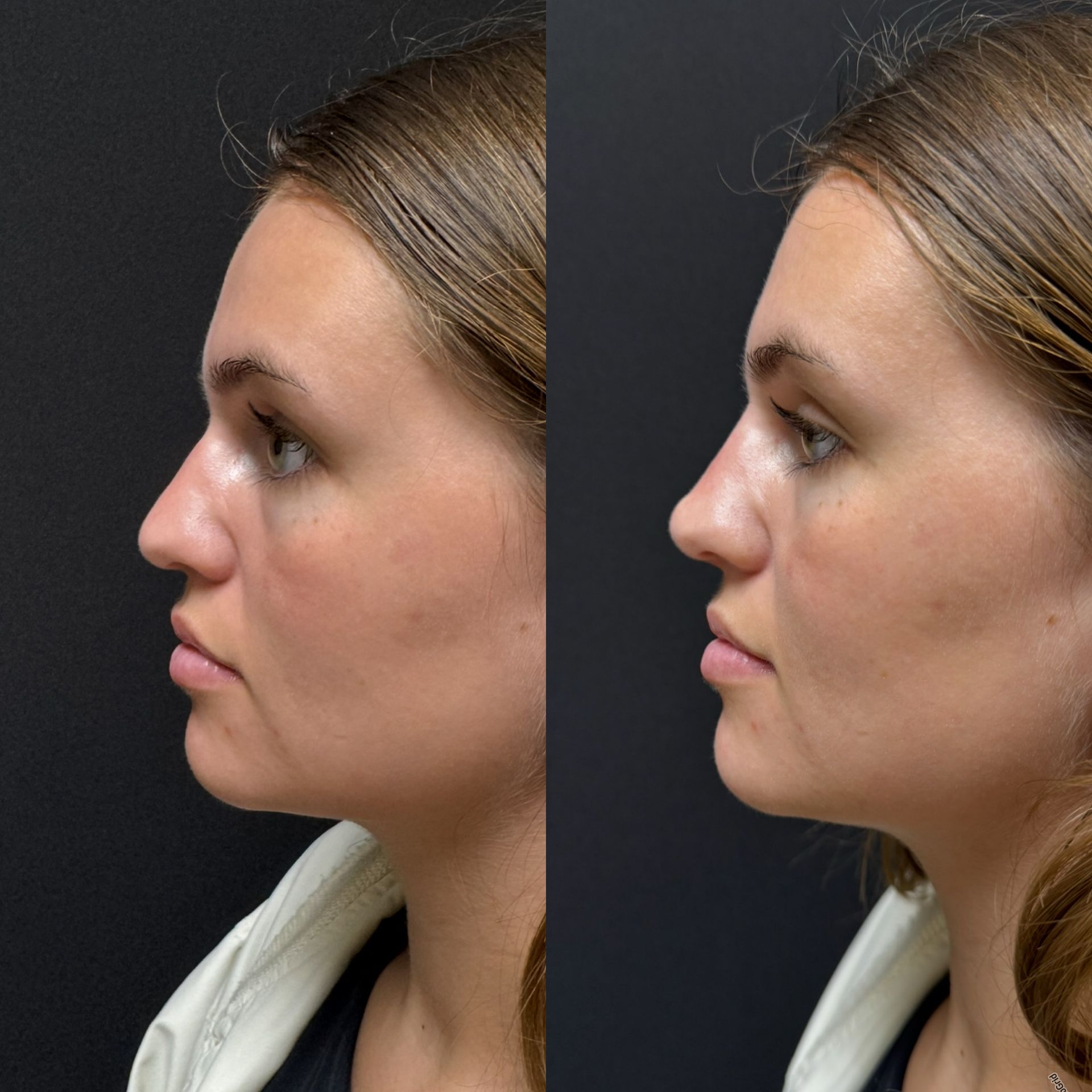 Side-by-side profile photos of a woman against a dark background, showing before and after changes.