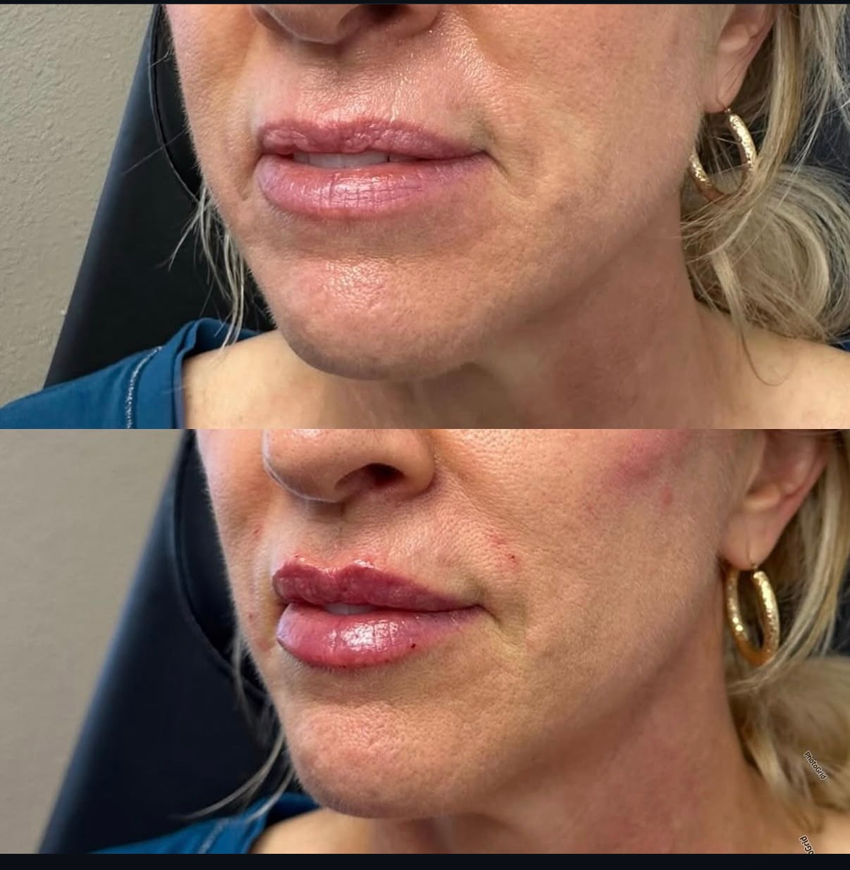 Split close-up of a person’s mouth and chin, showing lips before and after lipstick application