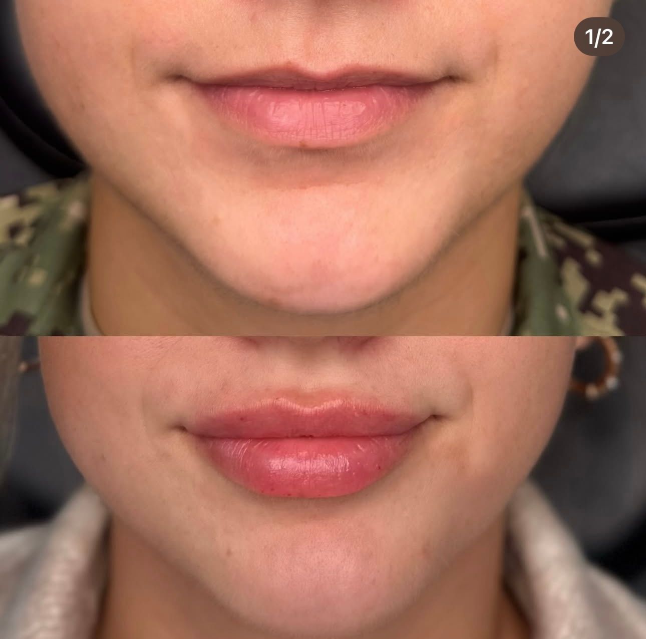 Side-by-side close-up of lips: top natural, bottom with glossy pink lipstick.