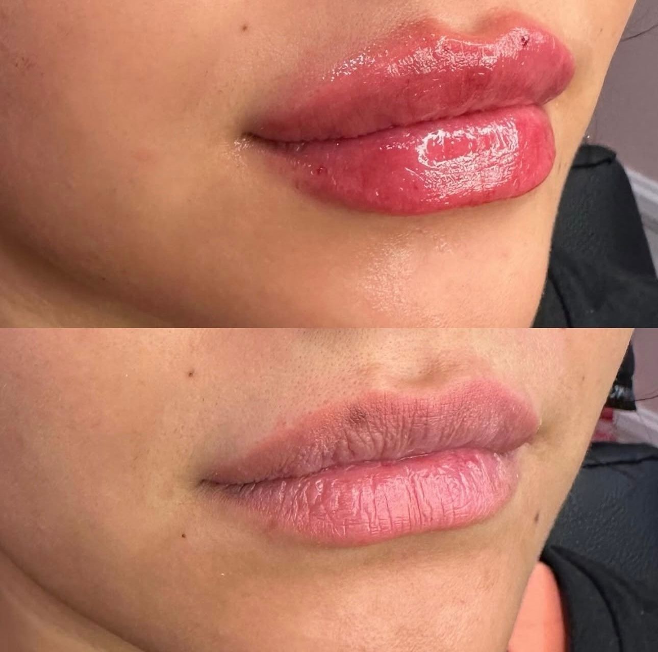 Close-up comparison of lips with glossy pink lipstick above and natural lips below