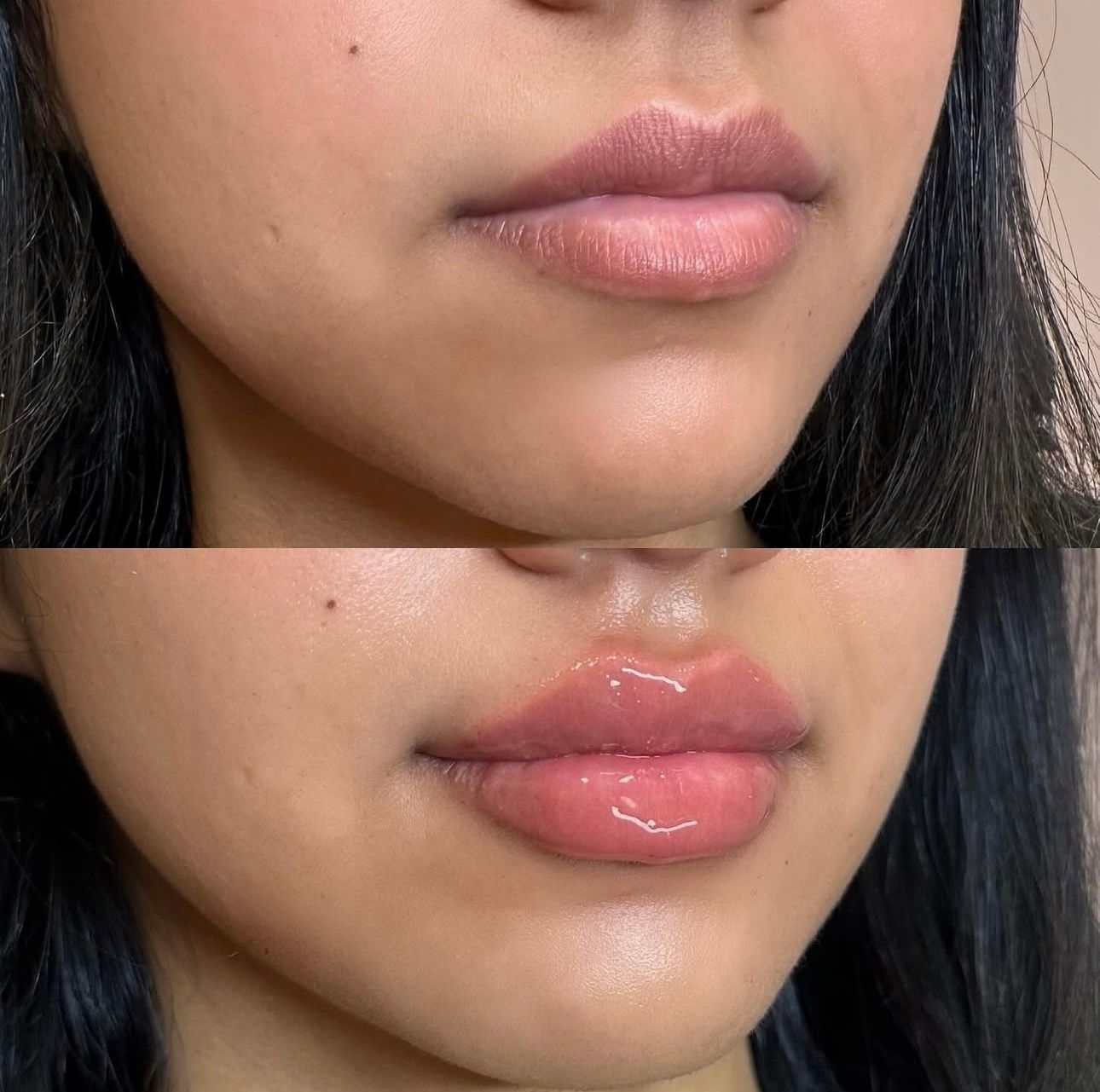 Side-by-side close-up of lips, before and after lip gloss application