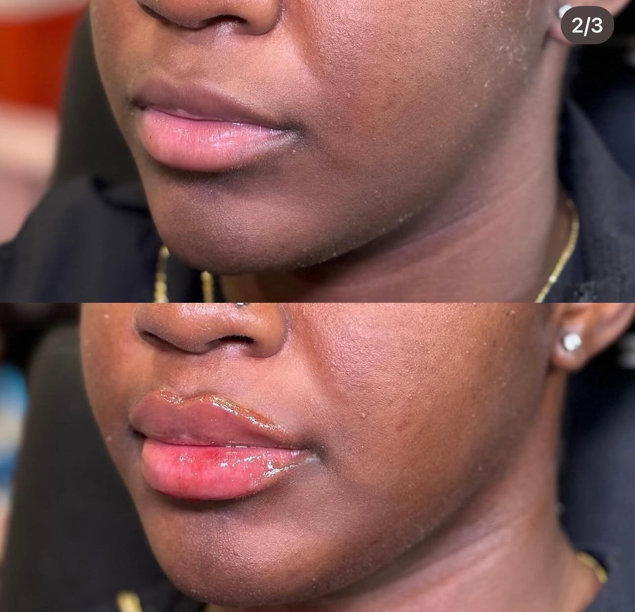 Close-up of lips before and after applying red lipstick, shown in a split comparison.