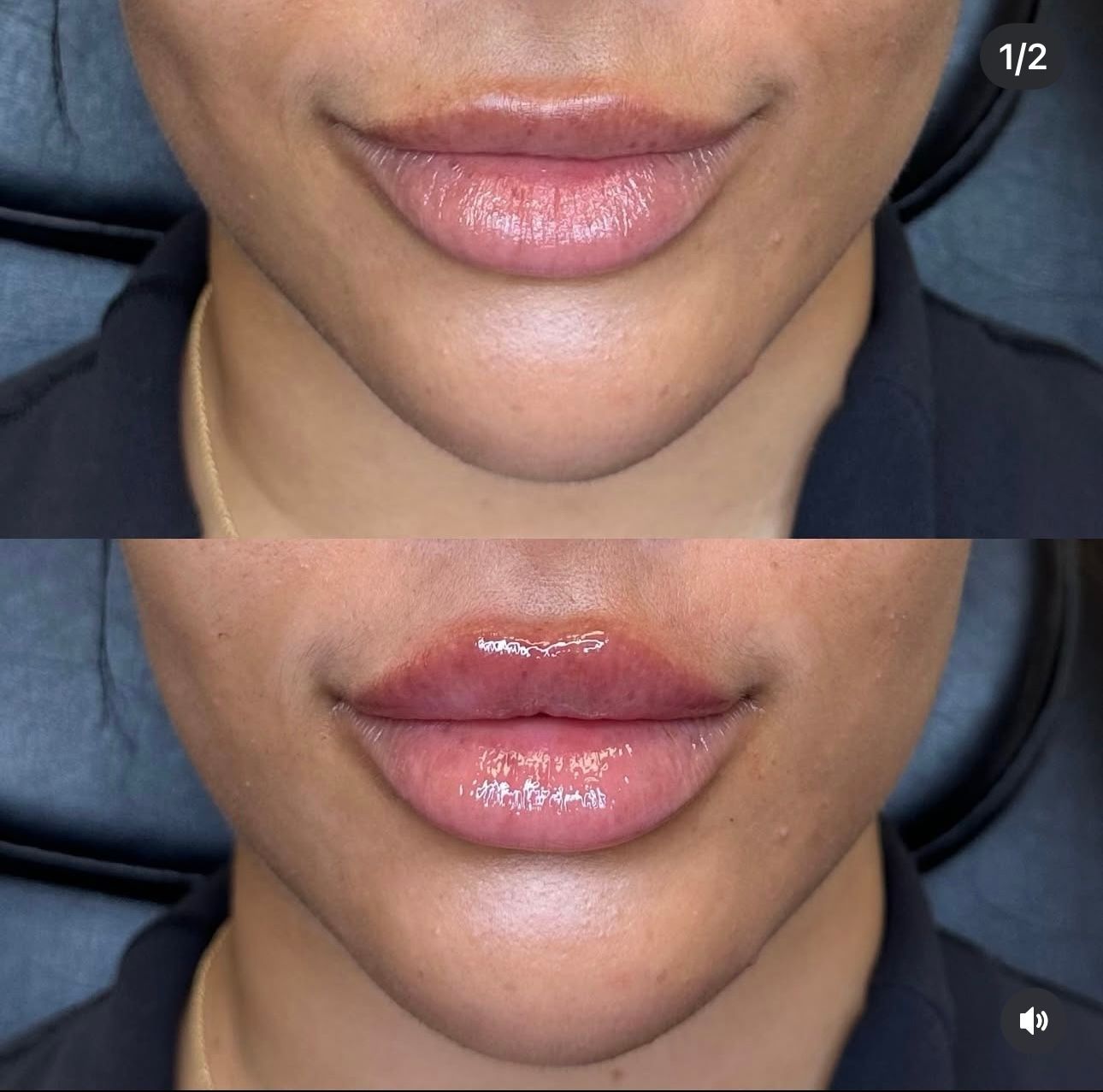 Close-up of lips before and after gloss application, shown in a side-by-side comparison.