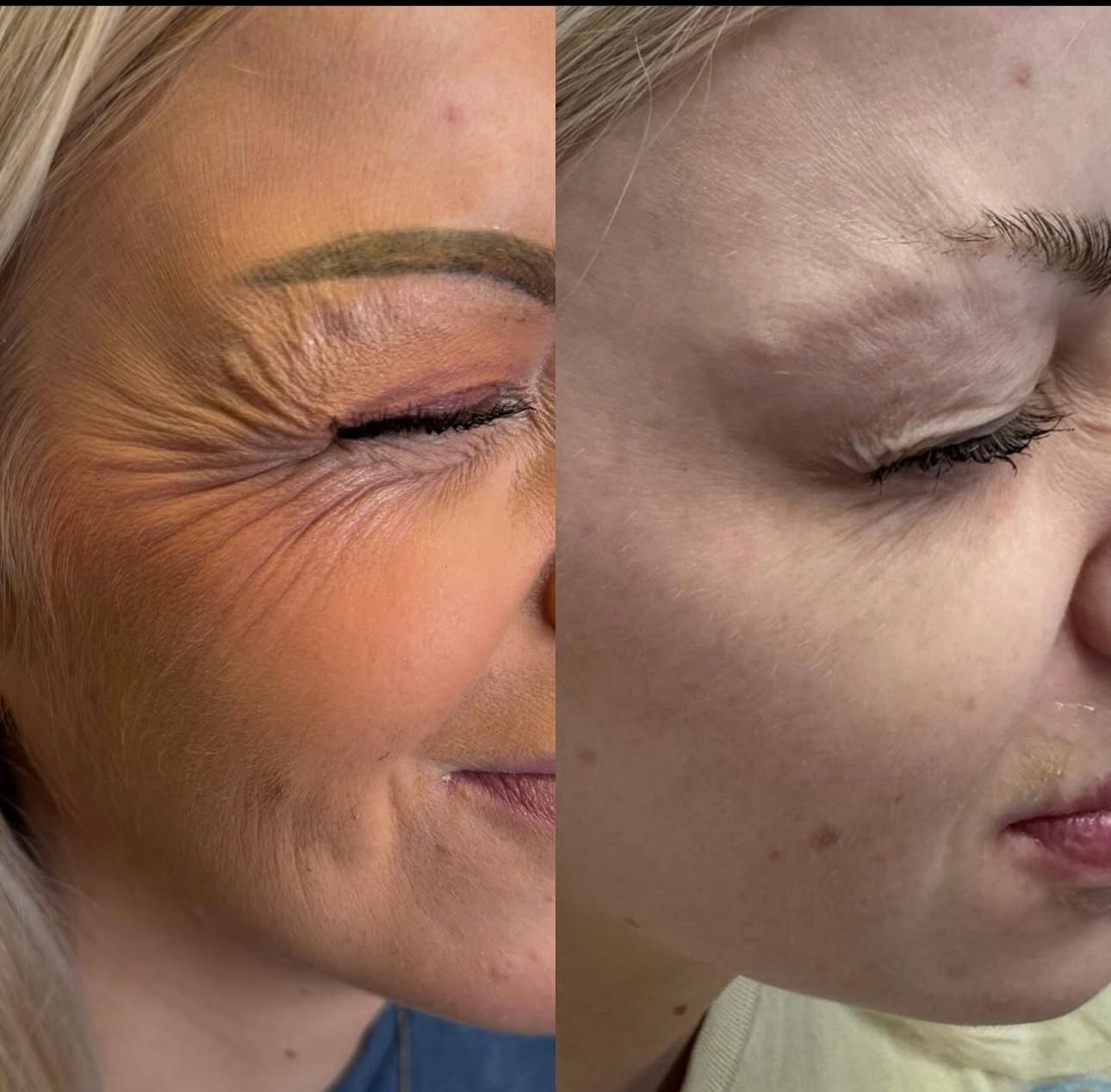 Close-up side-by-side profile of two faces with closed eyes, showing wrinkles and different skin tones.