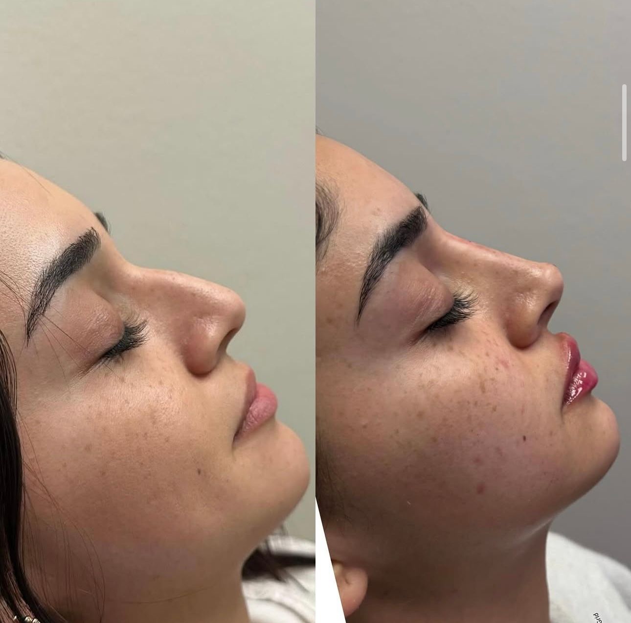 Side-by-side profile close-up of a woman's face before and after lip gloss and skin makeup application.