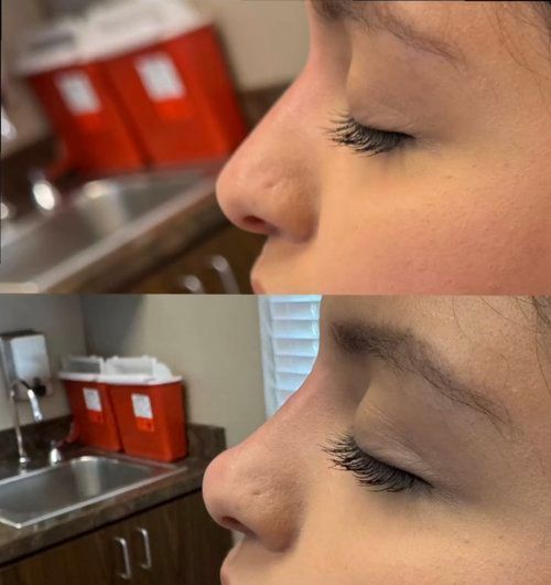Side-by-side close-up of a closed eye and nose in a kitchen, with before-and-after-style comparison lighting