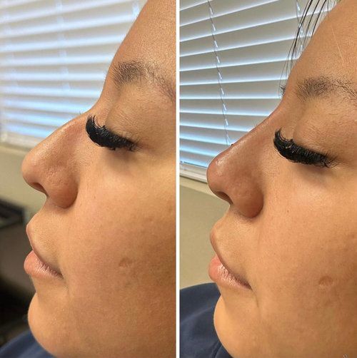 Side-by-side profile close-up of a face before and after makeup, with fuller false eyelashes.
