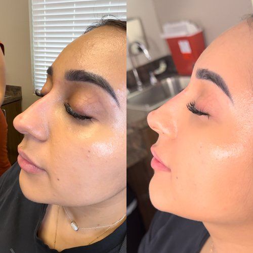 Side-by-side close-up of a woman’s profile before and after makeup with highlighted cheekbone.