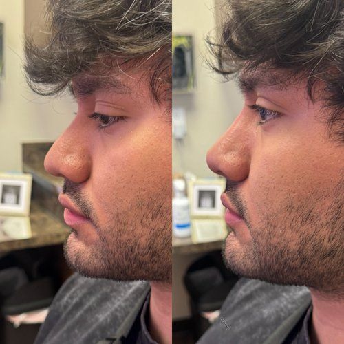 Side-by-side side profile of a man indoors with short wavy hair and stubble, wearing a dark jacket