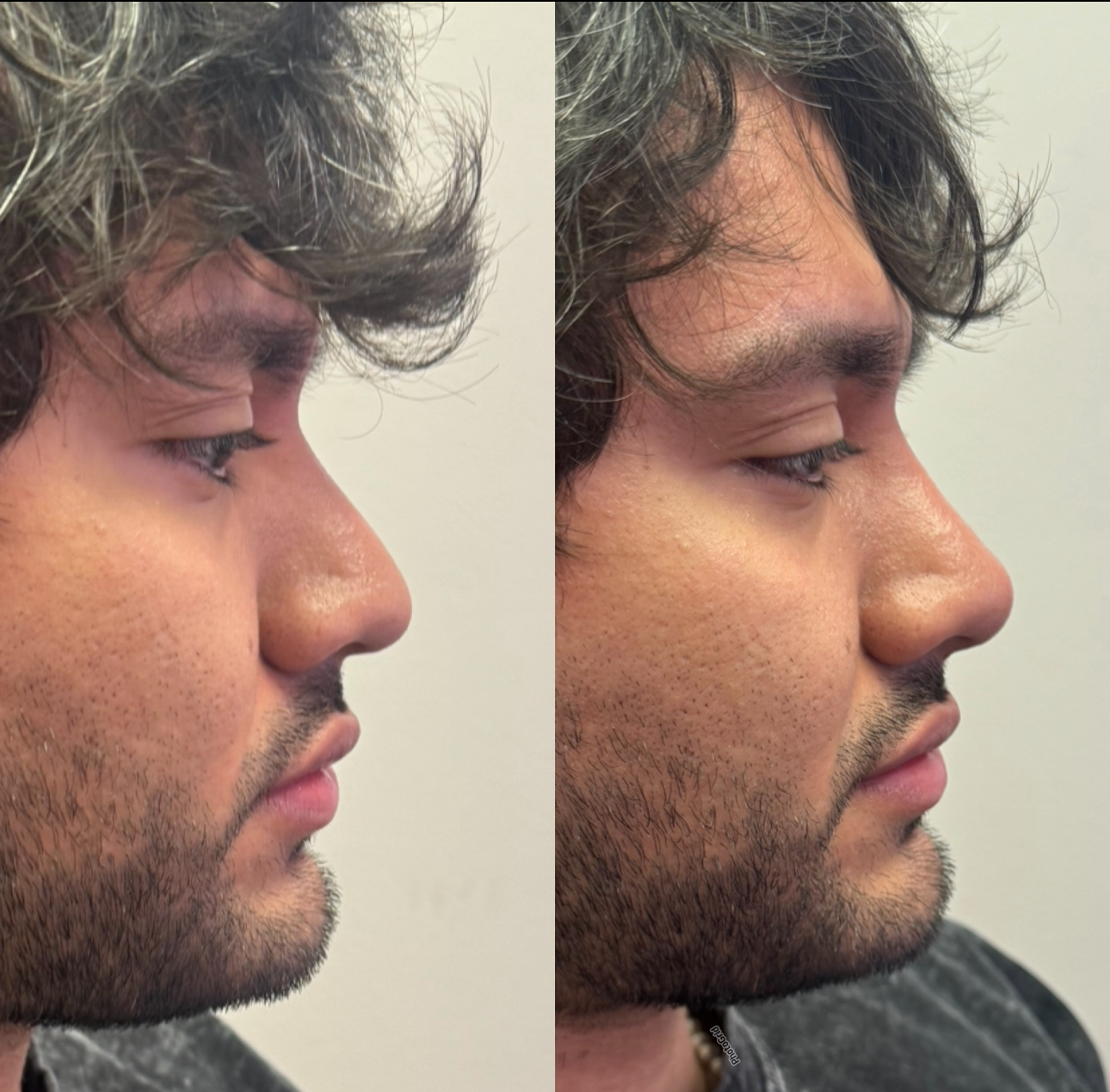 Side-by-side profile photos of a man with curly hair and facial hair, showing a before-and-after look.