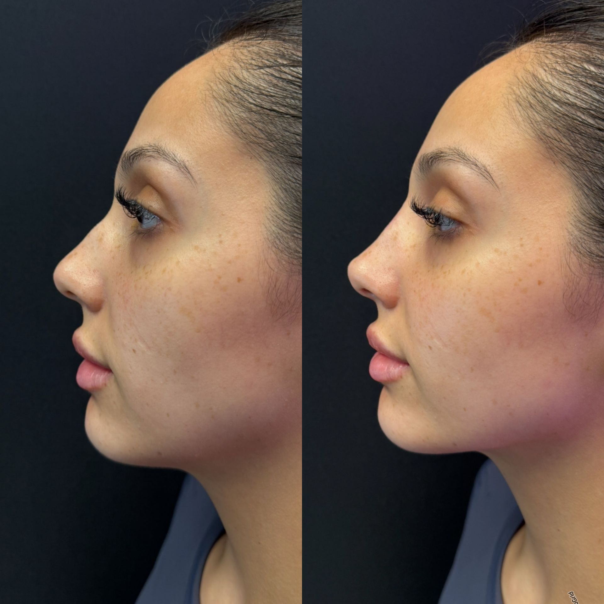 Side-by-side profile views of a woman before and after facial makeup, showing smoother skin and pink lipstick.