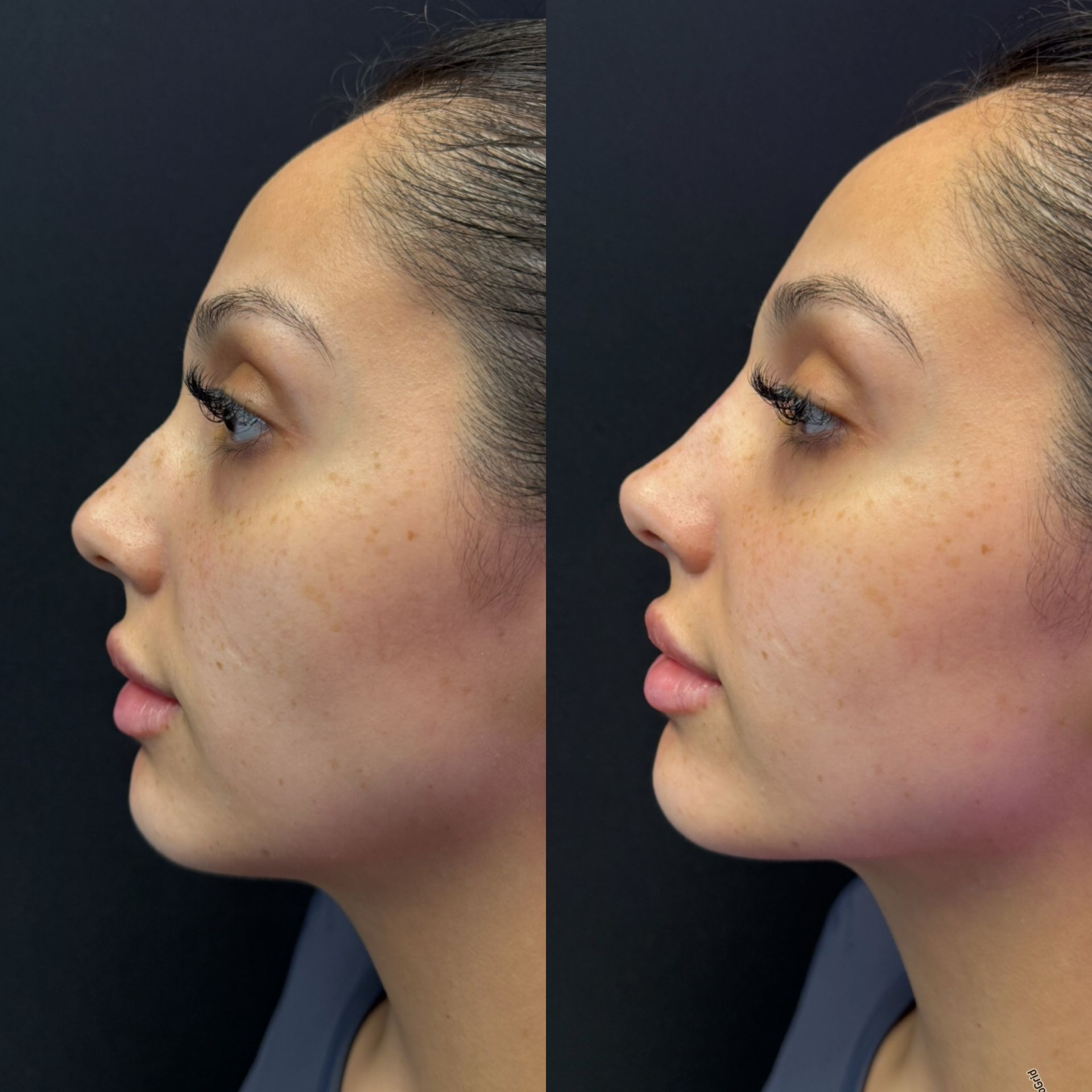 Side-by-side profile photos of the same woman with slight makeup and lighting differences.