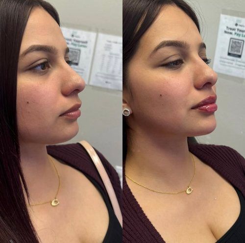 Side-by-side profile portraits of a woman indoors, wearing a burgundy top and gold necklace.