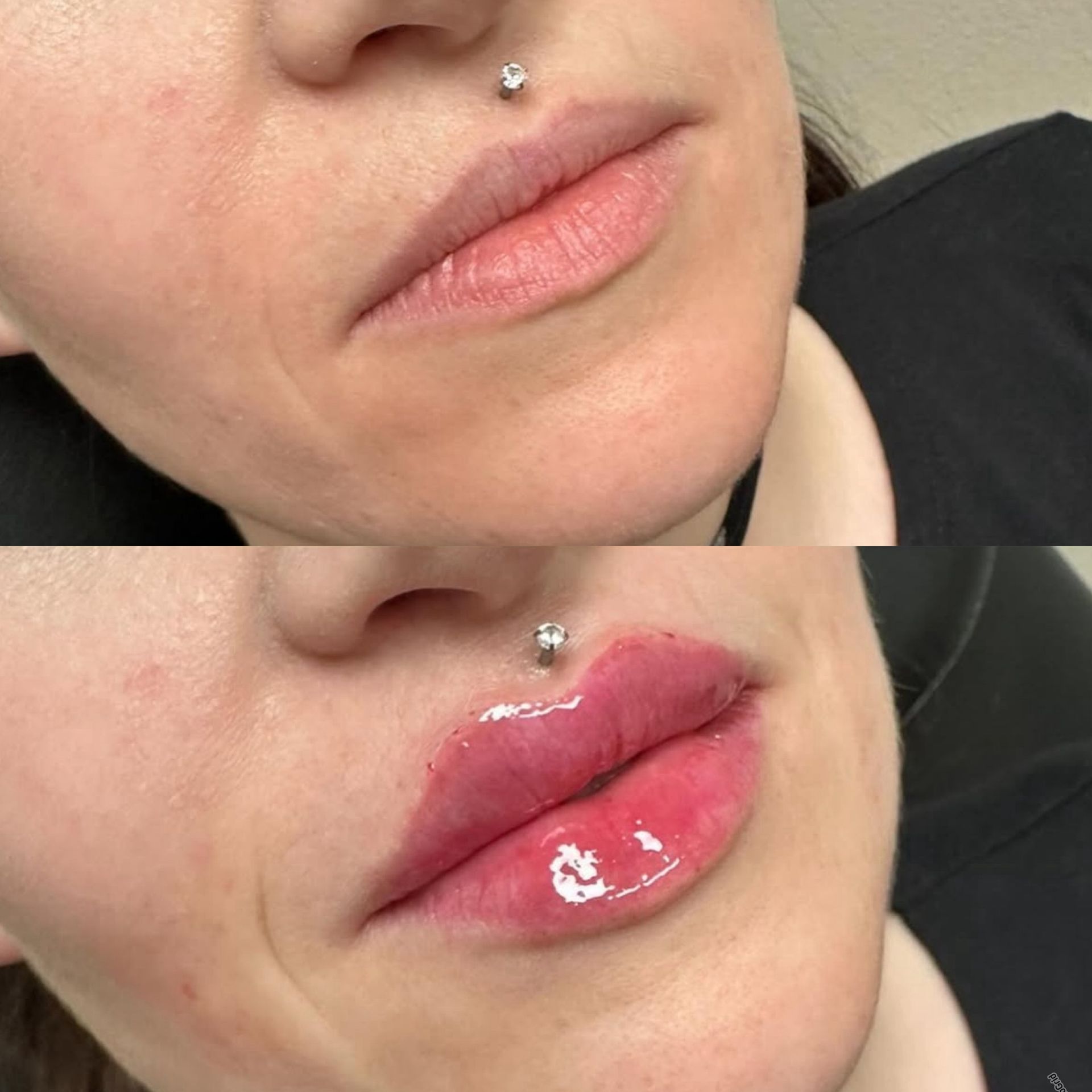 Close-up of lips with a silver nose stud, shown before and after glossy lip treatment.