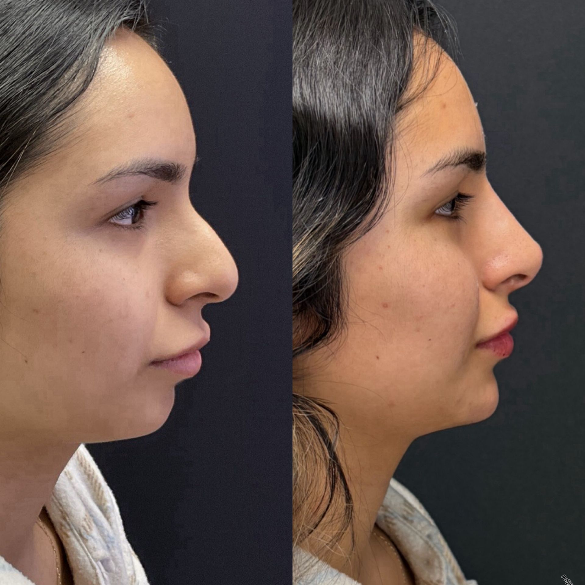 Side-by-side profile portraits showing a woman’s face before and after makeup on a dark background