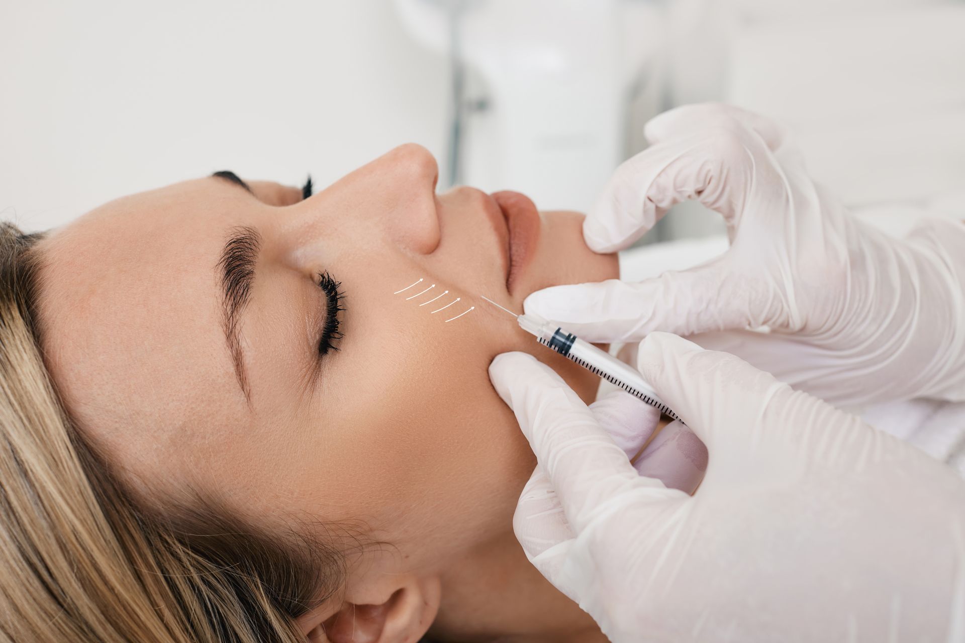 A gloved practitioner injects filler into a woman's cheek during a cosmetic procedure.