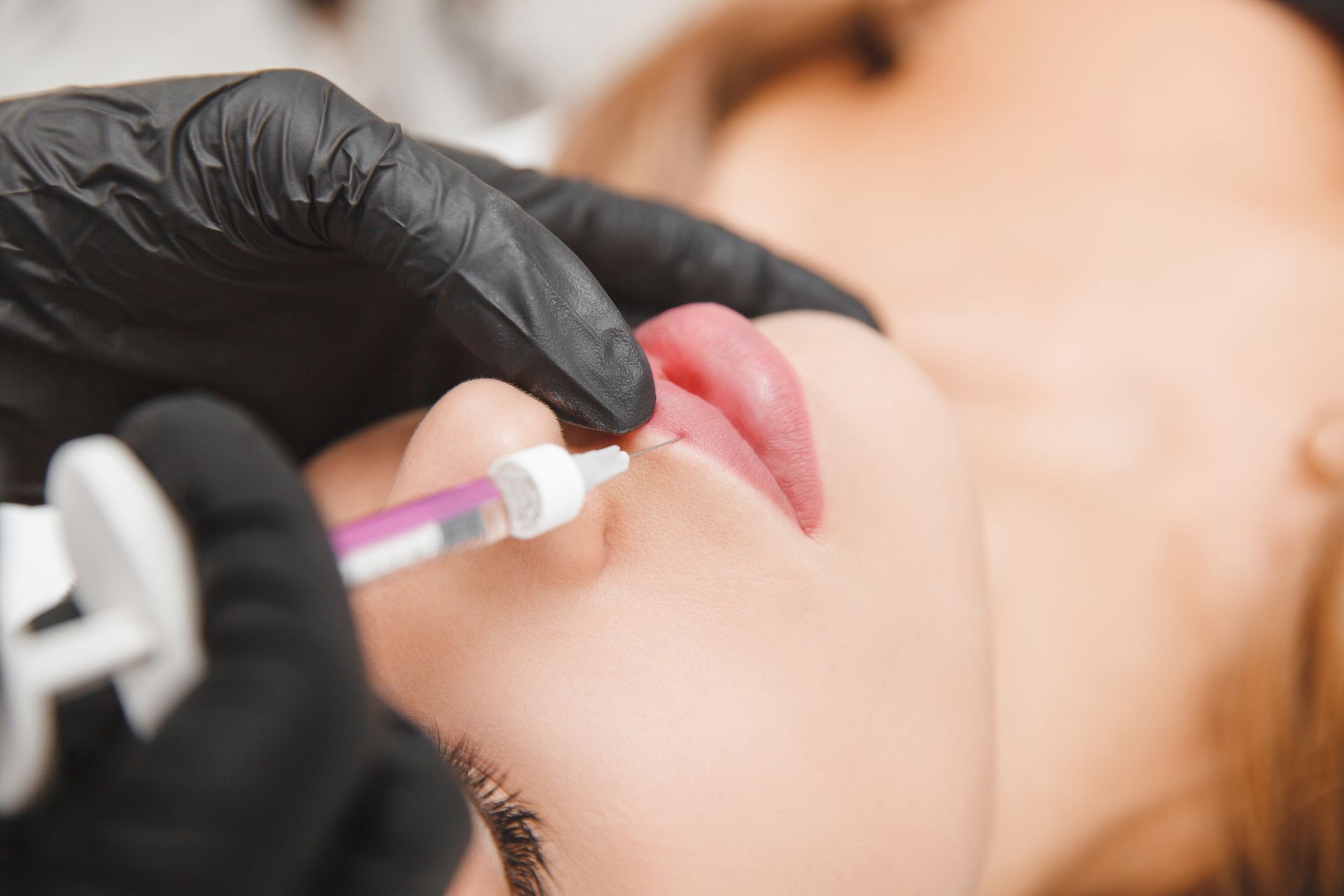 Gloved hands inject filler into a woman’s lips during a cosmetic procedure