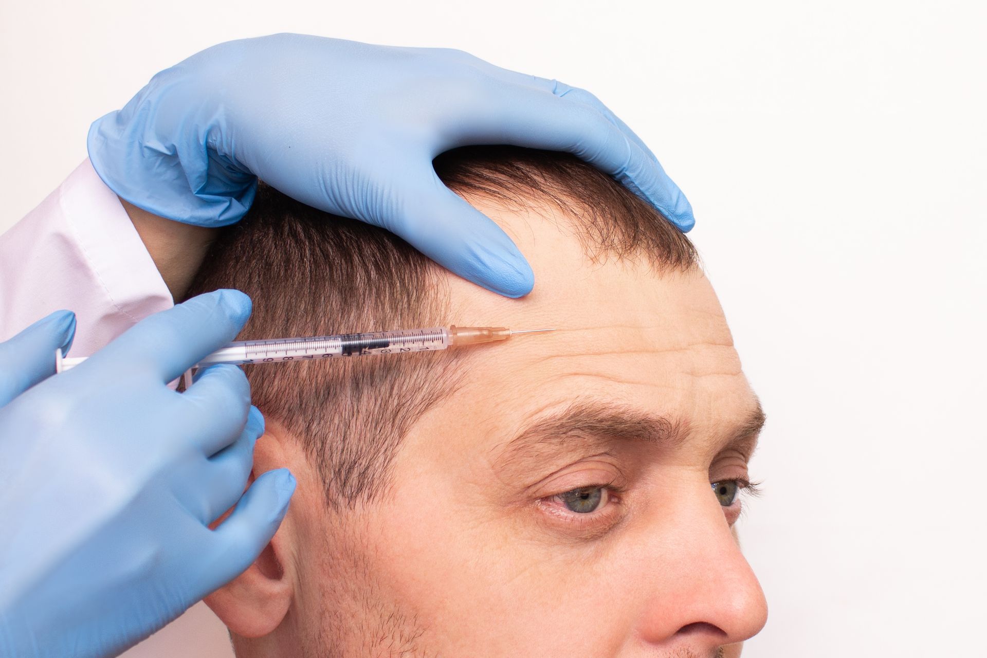 Gloved hands inject a syringe into a man’s temple during a cosmetic procedure