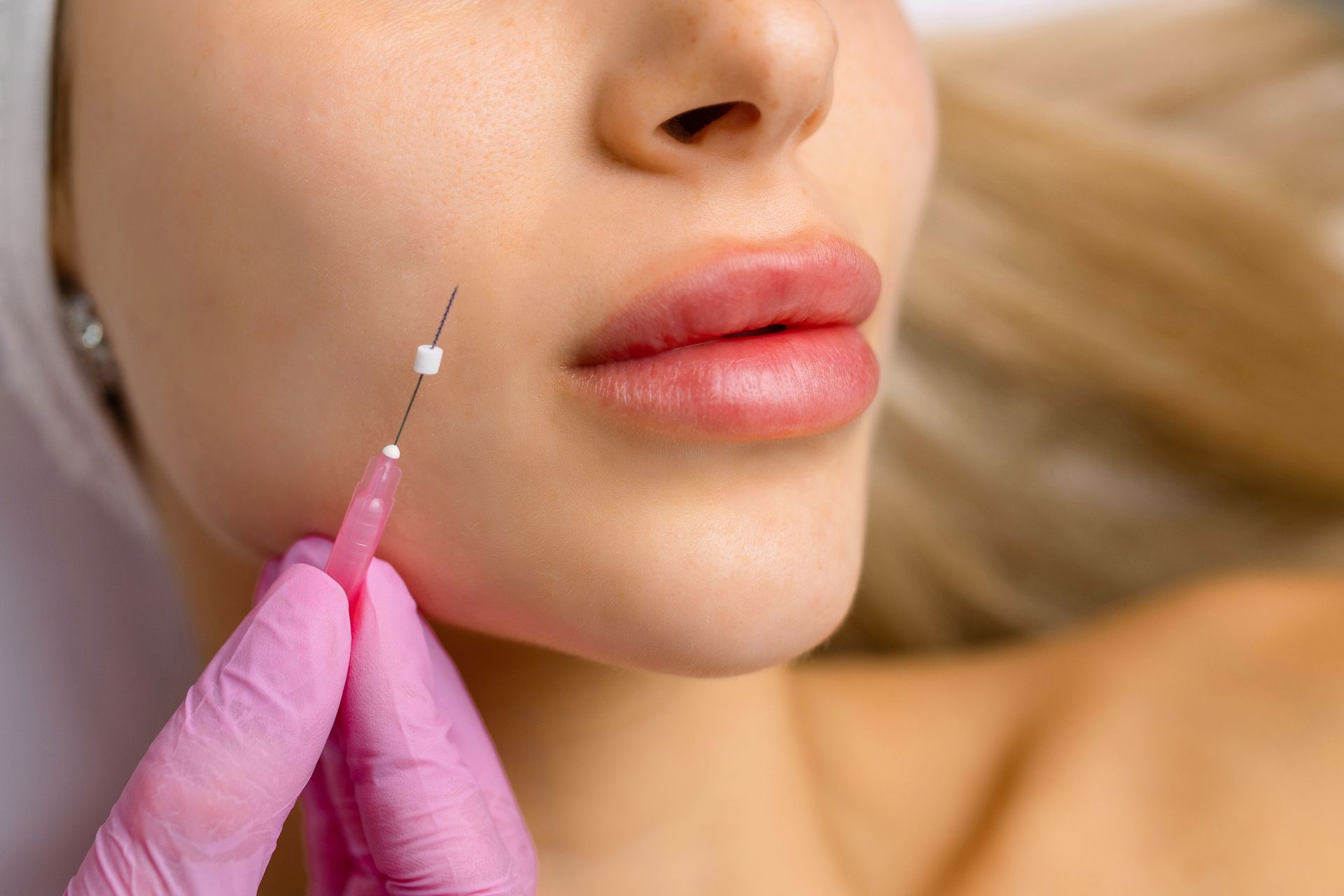 Close-up of lips and cheek during a cosmetic injection, with a gloved hand holding a syringe