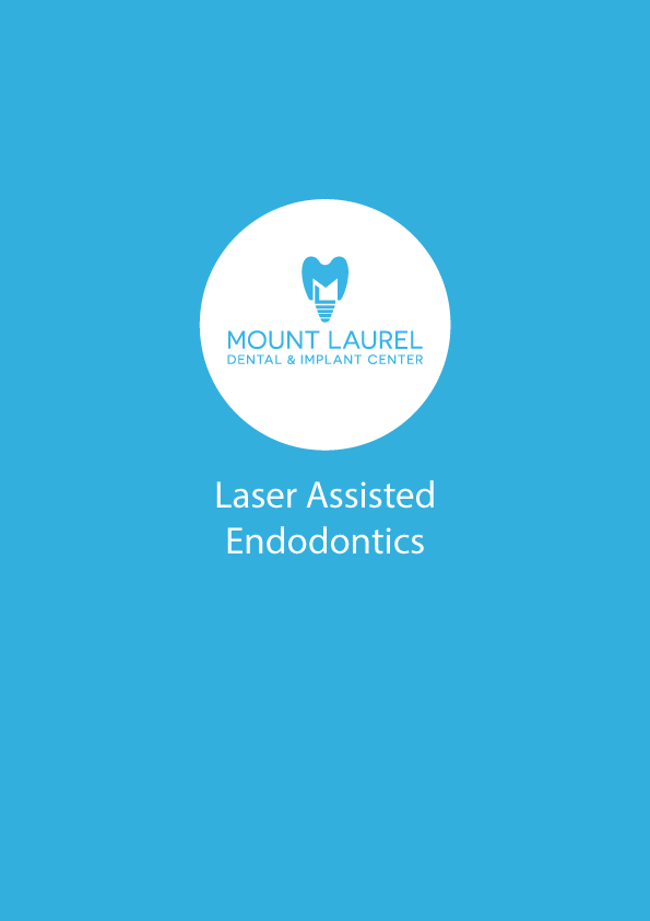 Mount laurel dental implant center offers laser assisted endodontics