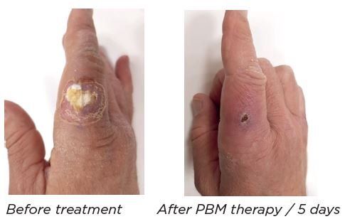 A before and after picture of a person's hand.