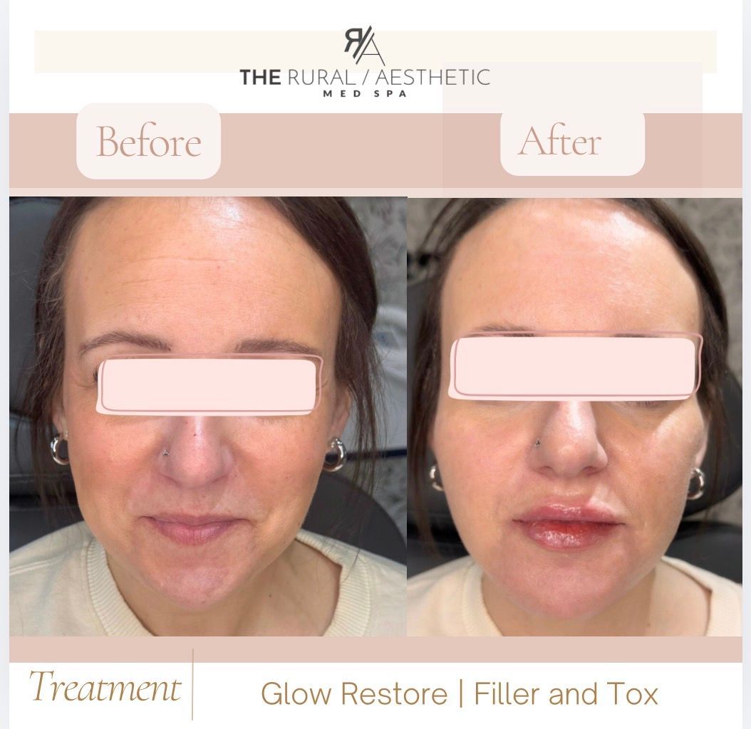 Side-by-side before and after facial treatment photos, showing a smoother, more glowing face on the right.