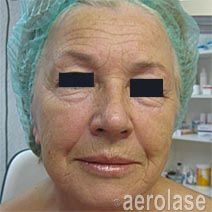 Woman with wrinkles on face, wearing a medical cap. Focus on face.