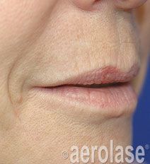 Close-up of human lips, with slight redness and lines.