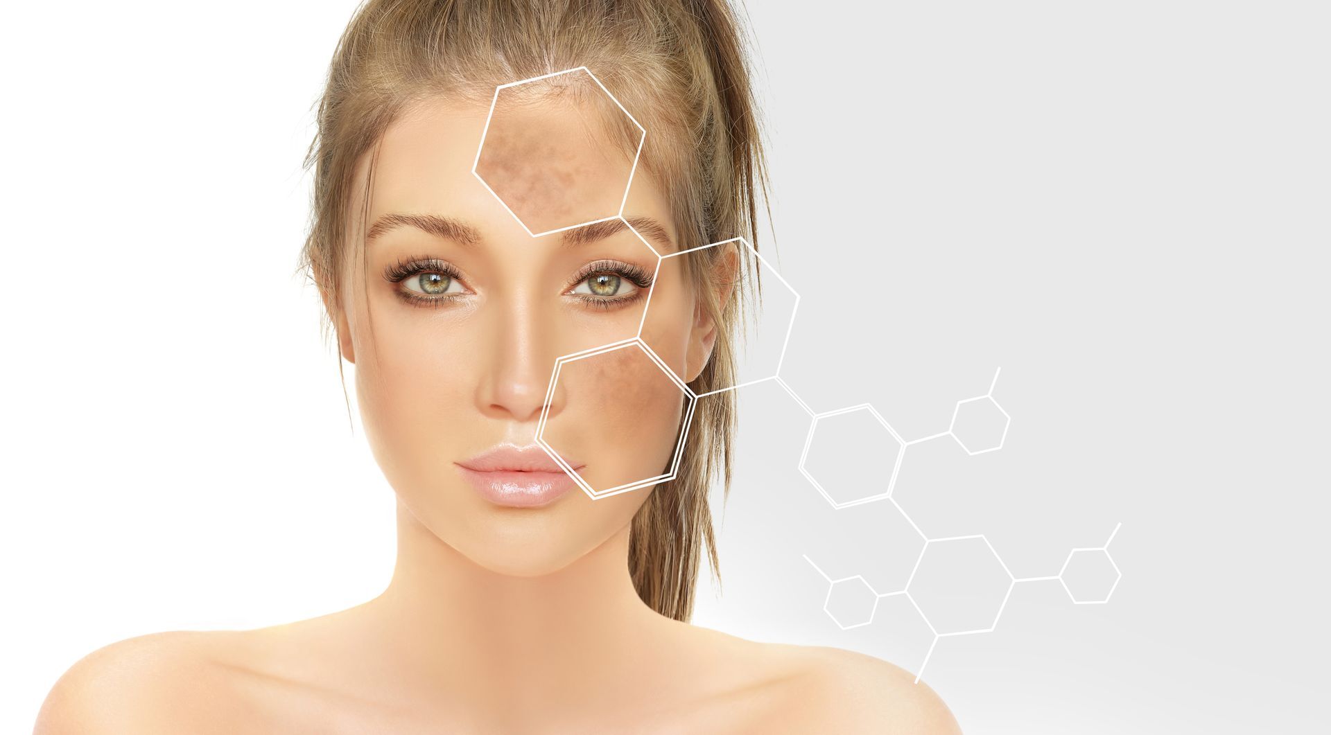 Woman with skin discoloration, highlighted with molecular structure diagram.