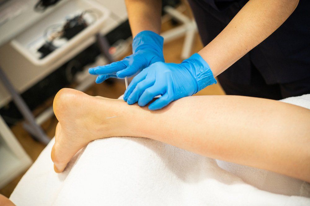 Close Up of a Needle and Hands of Physiotherapist Doing a Dry Needling in a Physiotherapy Center — PhysioCare Townsville In Thuringowa Central, QLD