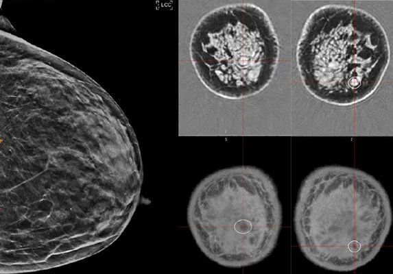 a breast exam image