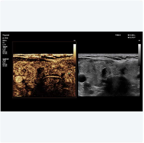 ultrasound image of a baby