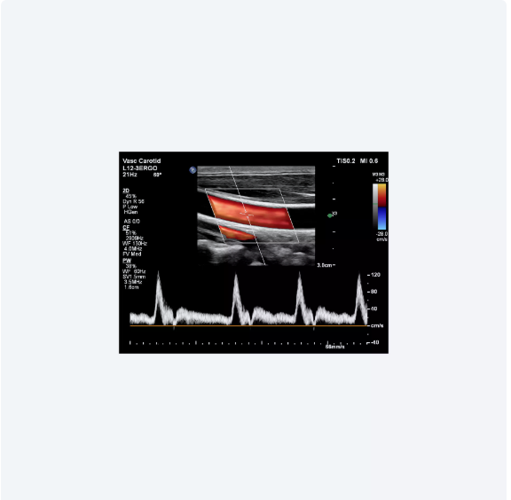 ultrasound image of a baby