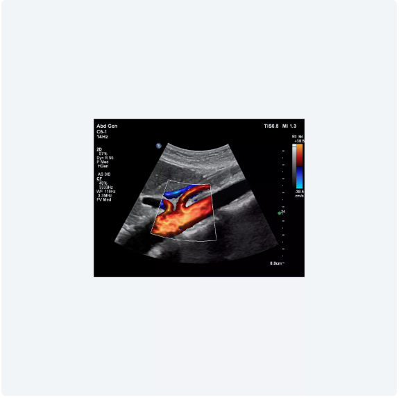 ultrasound image