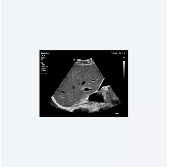 ultrasound image of a baby